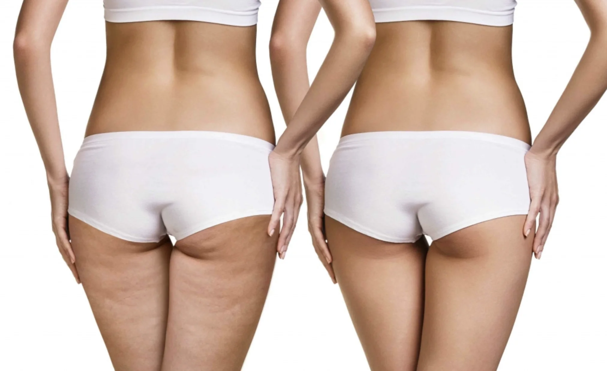 Абонемент на Lpg массаж тела 45