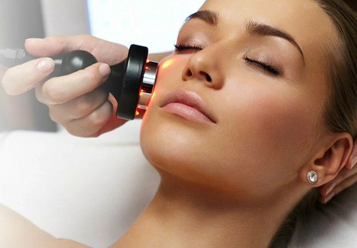 Абонемент RF-лифтинг лица